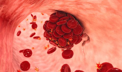 Ако усетите това на крака си, може да имате тромб