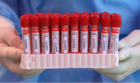 263 нови случая на коронавирус, починаха още двама заразени