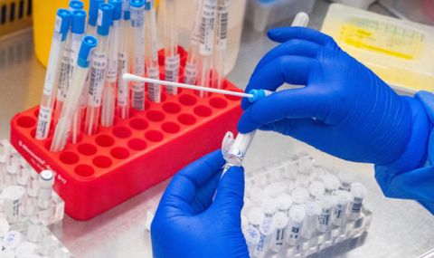 866 нови случаи на коронавирус, почина един заразен