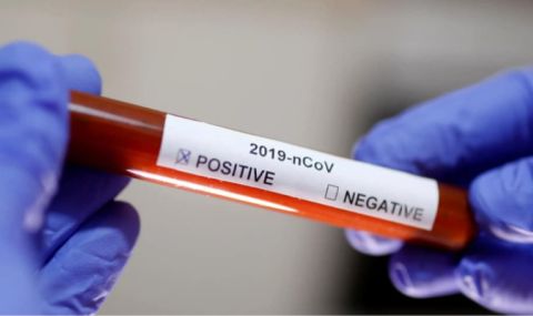 129 нови болни с коронавирус, починаха четирима за денонощие
